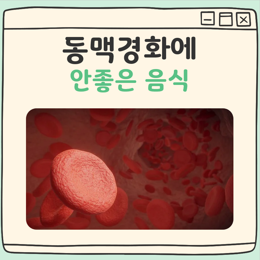 동맥경화에 안좋은 음식 대표 이미지