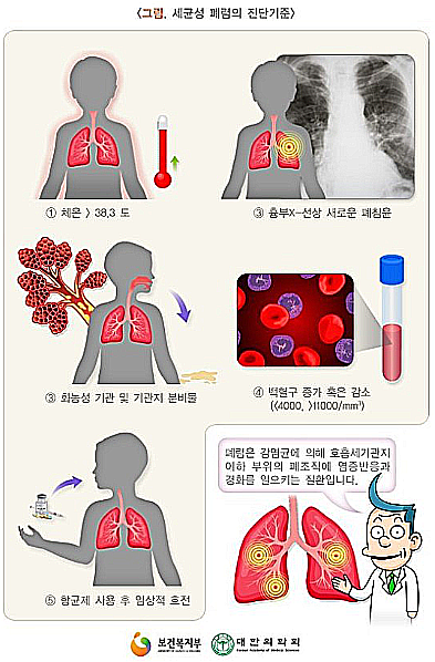 폐렴의 진단 기준/ 출처 - 보건복지부