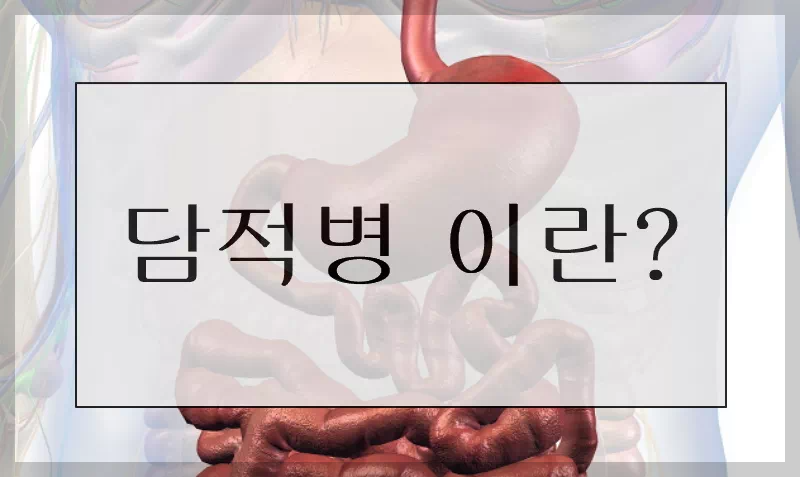 담적병이란