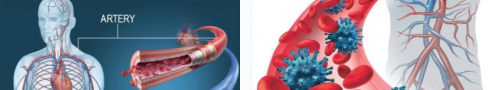 사람의 혈관을 보여주는 사진 그리고 정맥 동맥 위치