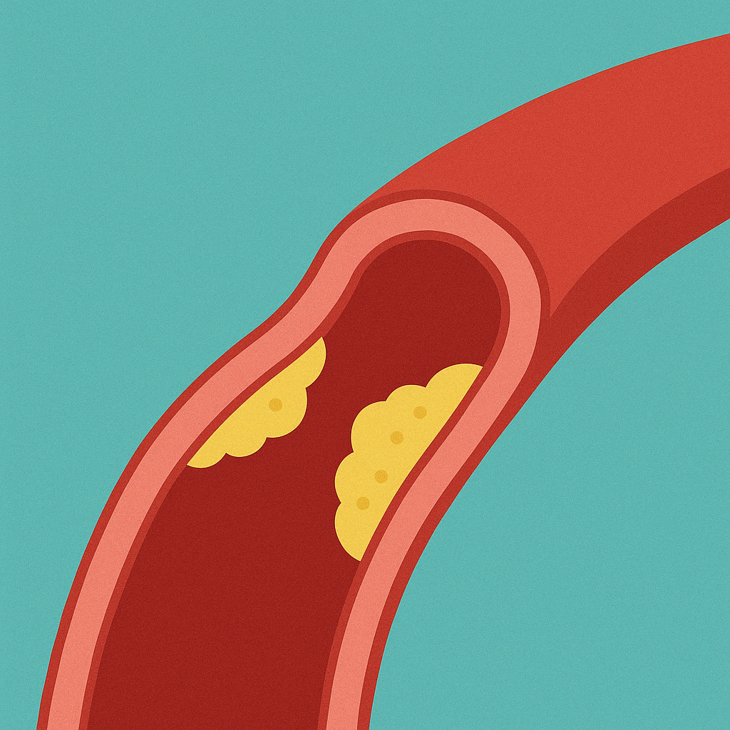 『2025 고지혈증 완전 정리 – 증상, 원인, 음식까지 한눈에!』