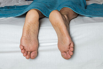 발바닥 껍질 벗겨짐 원인은?&amp;#44; 발바닥은 지속적인 충격을 받는 부위로 심장에서 가장 멀고 혈액순환이 잘 되지 않는 부위입니다. 일상생활 중 자주 손을 씻고 눈으로 확인하는 부분이지만&amp;#44; 발은 양말이나 신발을 신는 등 자주 눈여겨보지 않는 부분입니다. 그렇다면 왜 발바닥 껍질이 벗겨질까요?