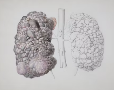 신장이 안좋으면 나타나는 증상