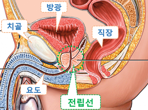 전립선비대증 치료방법 과연 있을까?