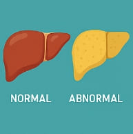 간수치 정상범위