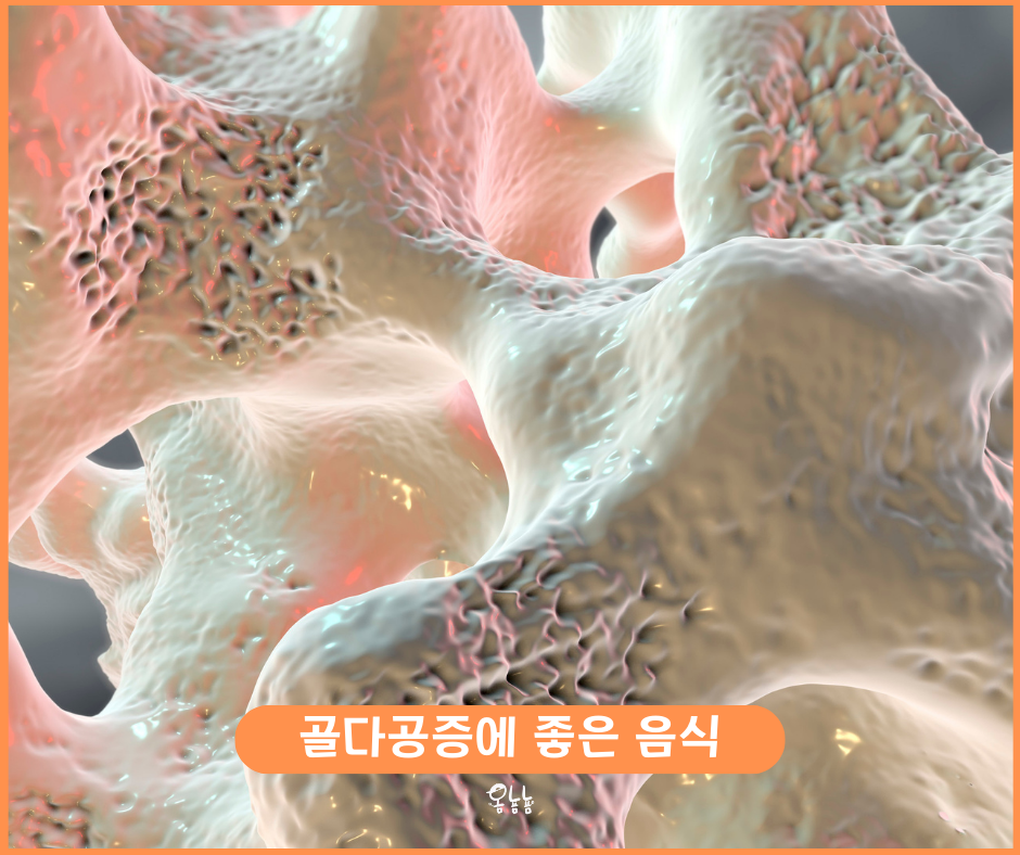 골다공증에 좋은 음식