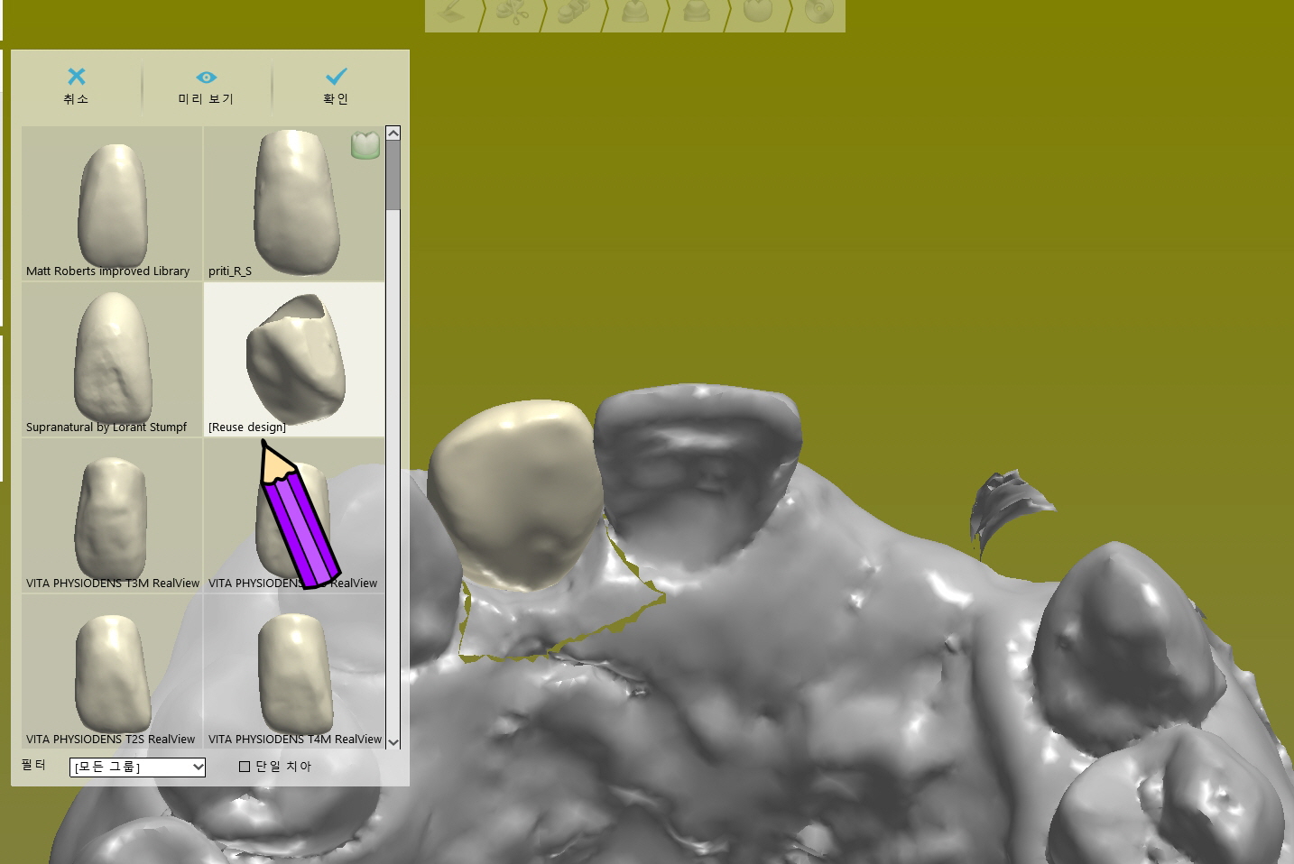 3shape reuse design 선택