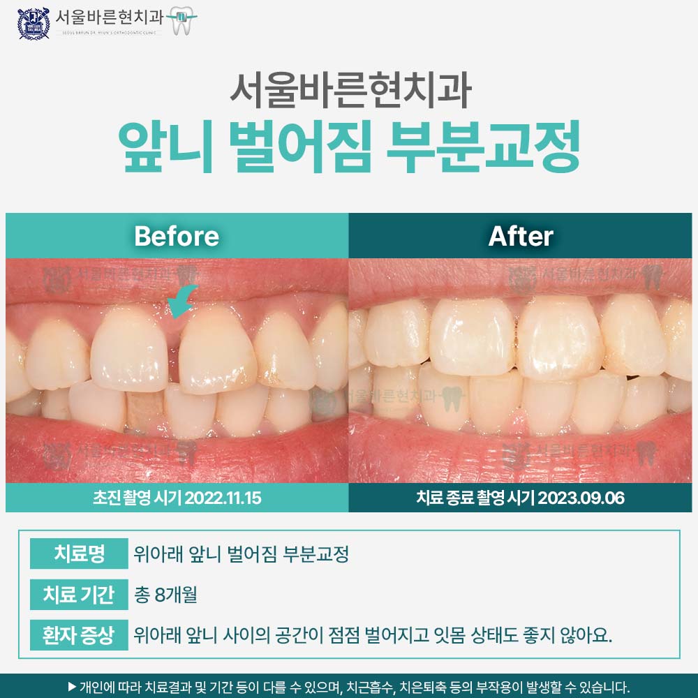 해운대교정치과