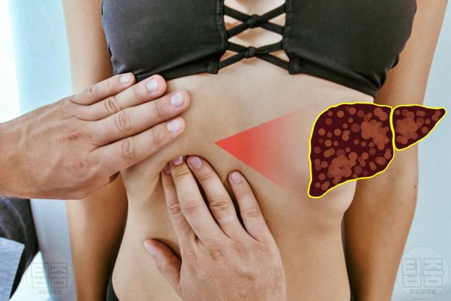 지방간 증상 비알코올성지방간 오른쪽 갈비뼈 아래 통증