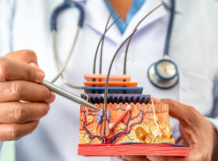 지루성 두피염 관리3