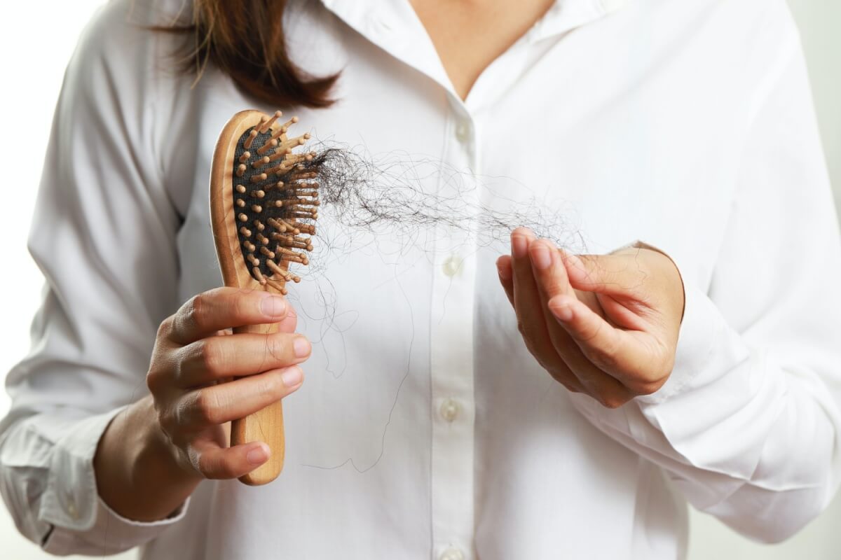 탈모가-진행중인-여성