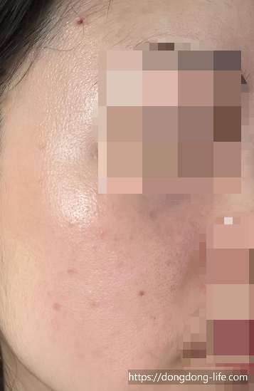 중계의원 기미 리뷰