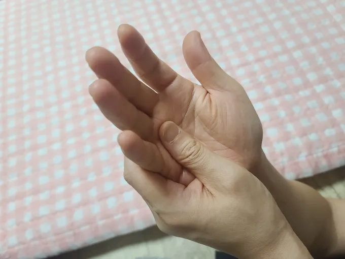 아침에 손이 붓는 이유