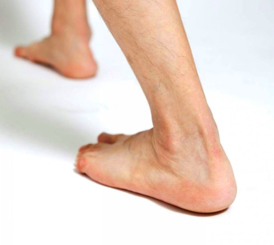 발바닥 통증 부위 진단과 치료