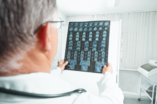 CT-사진보는-의사