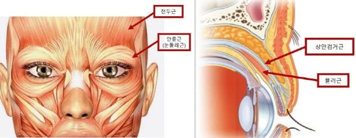 눈주변근육
