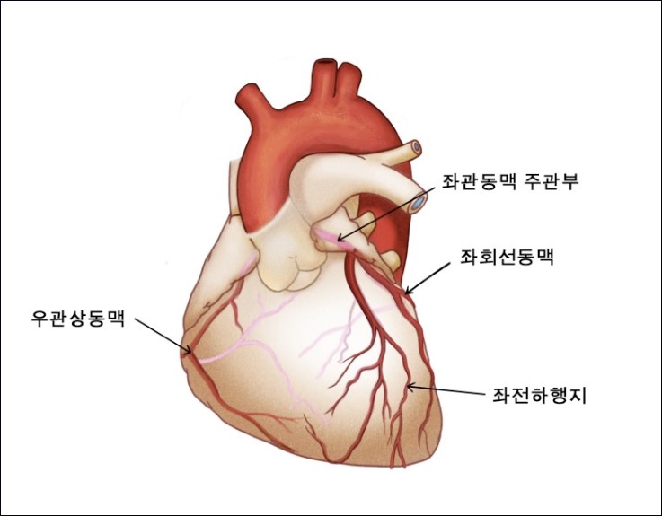 심장 혈관 3가지 관상동맥 그림