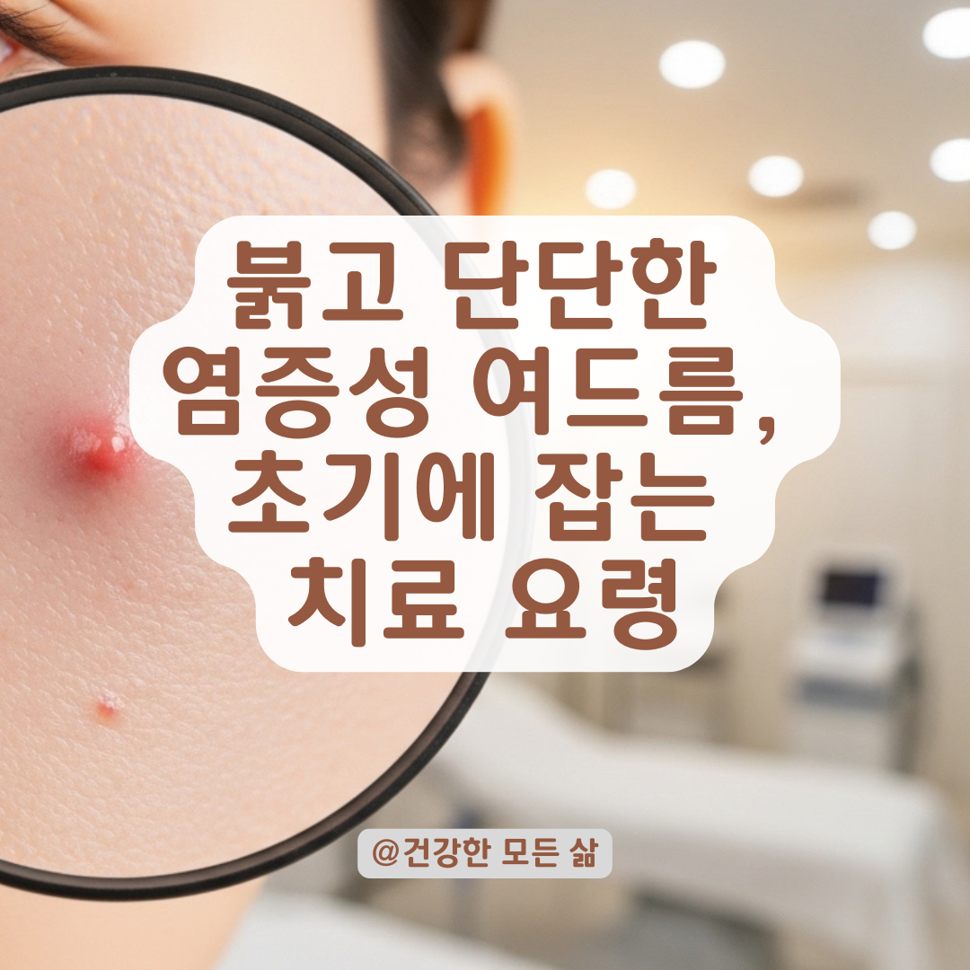 빨갛고 단단한 염증성 여드름, 초기에 잡는 치료법 요약.