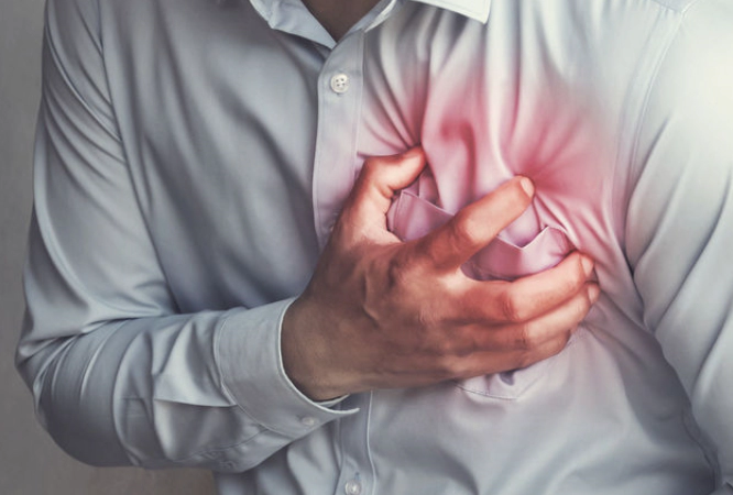 심근경색-심장마비-전조증상-원인