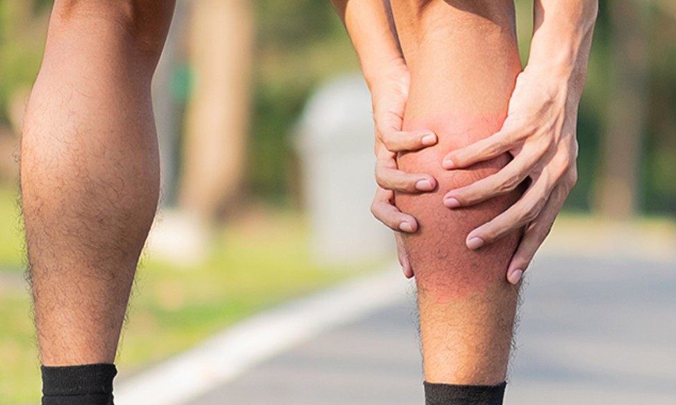 종아리-근육파열-증상