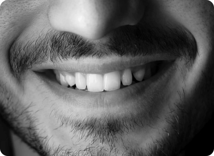 치아 미백관리 사진