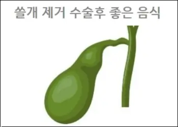 쓸개 제거 수술후 좋은 음식