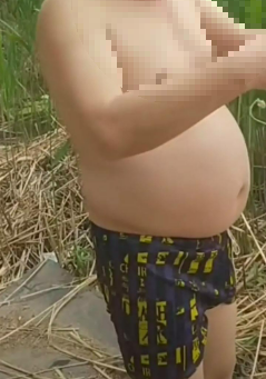 라셀턴 발톱세럼&amp;#44; 거품 나오는 문제성 무좀 발톱 치료 의약외품 2주 써봤다 