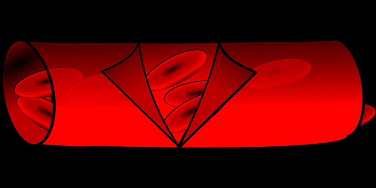 오메가3-효능-효과-고혈압-심혈관질환