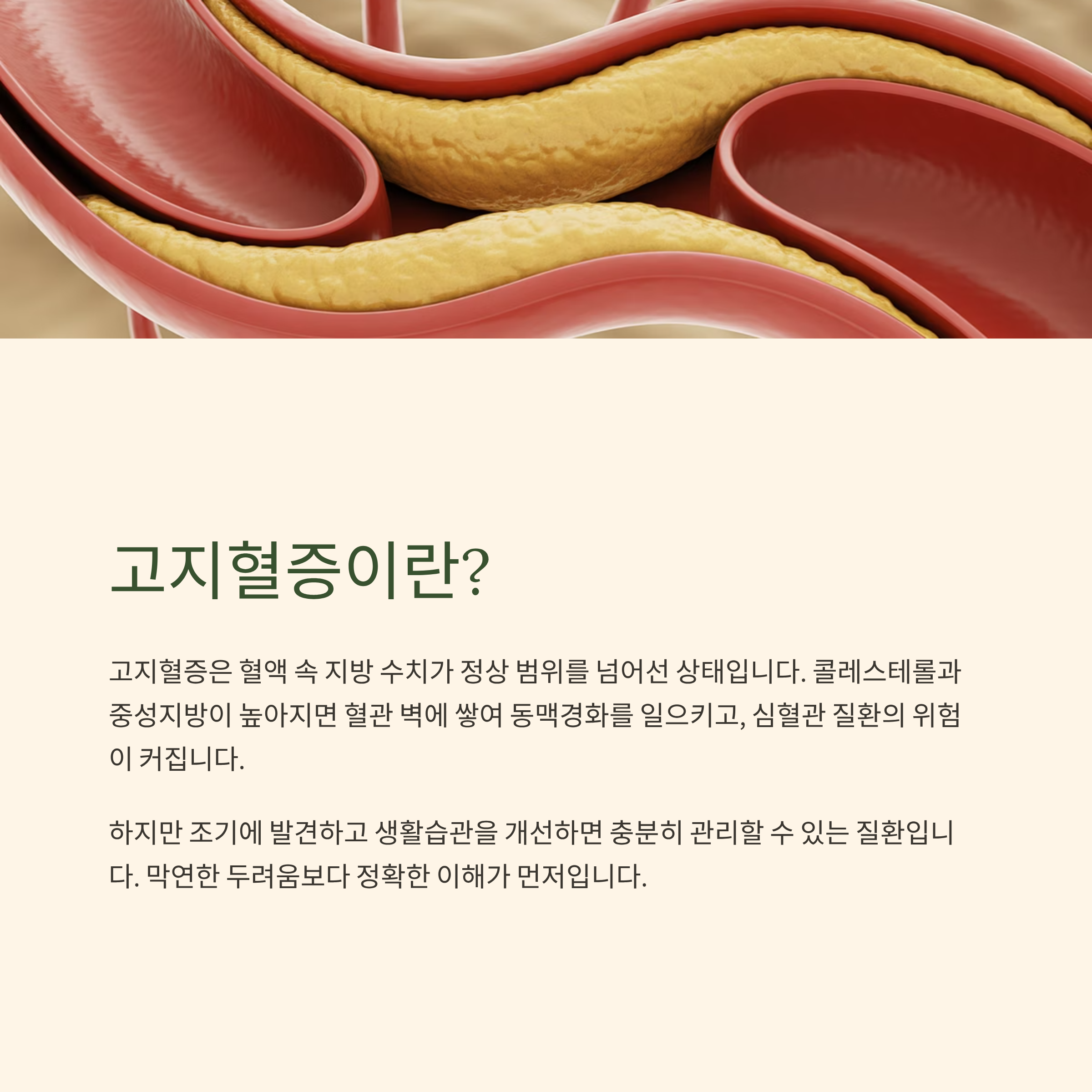 고지혈증이란?