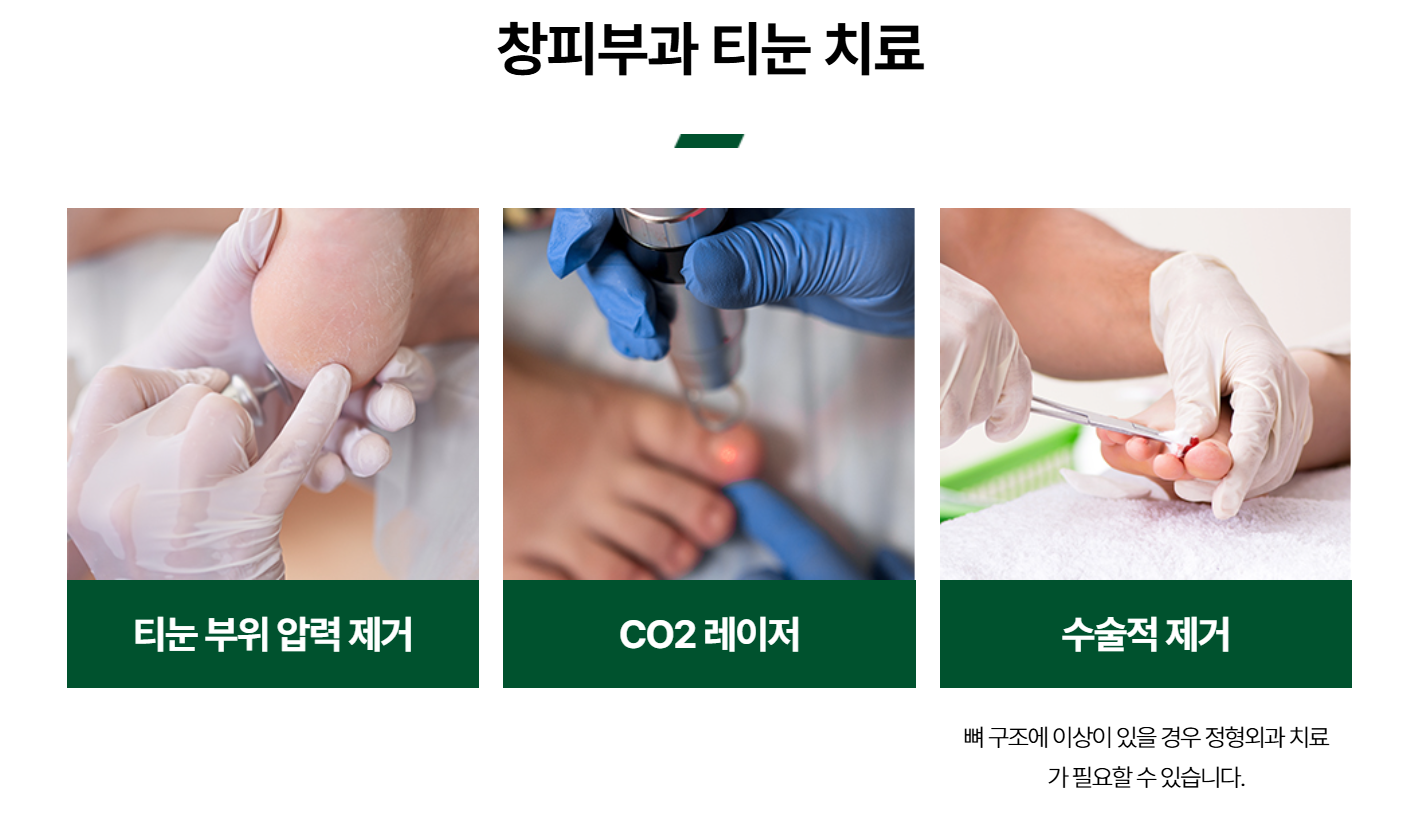 편평사마귀 원인, 증상, 치료 및 주의사항