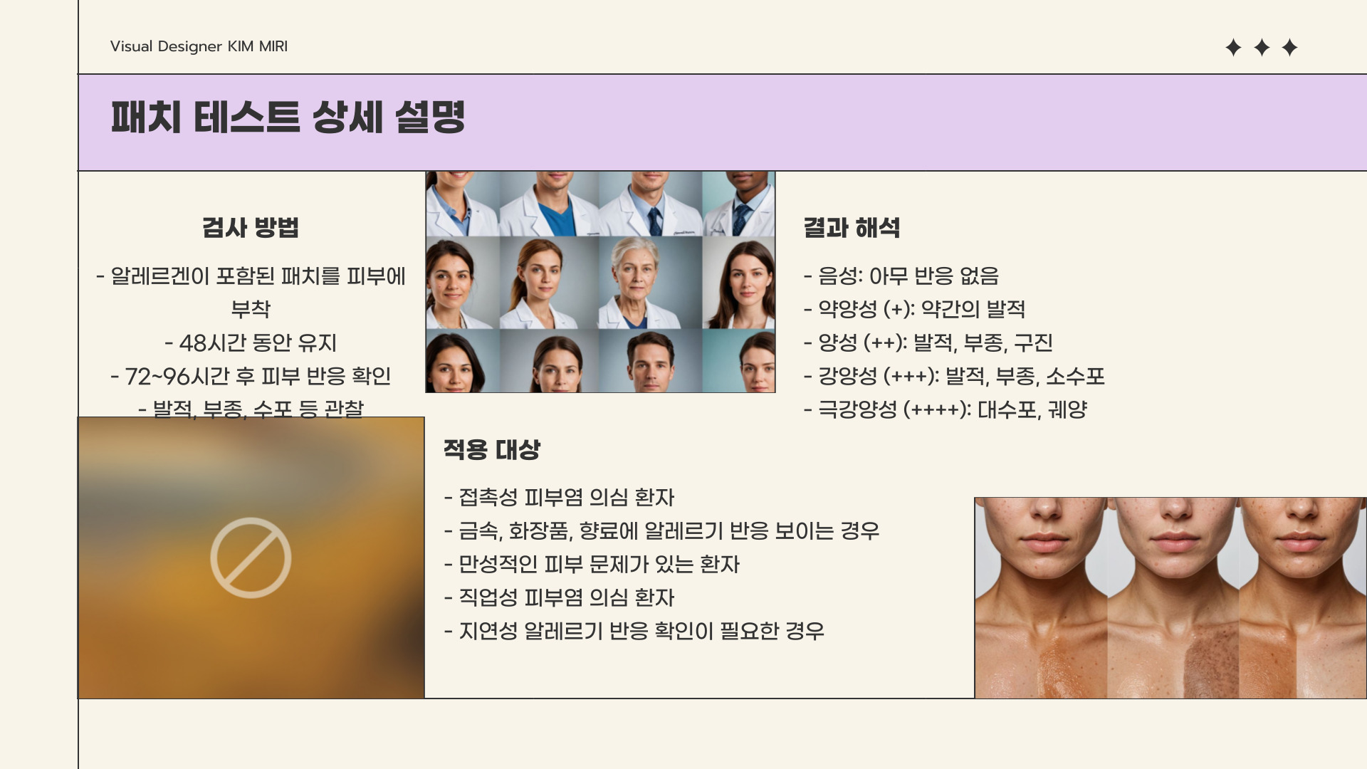 알레르기검사