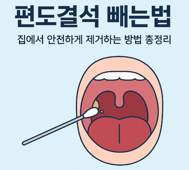 편도결석-빼는법-입냄새-제거법