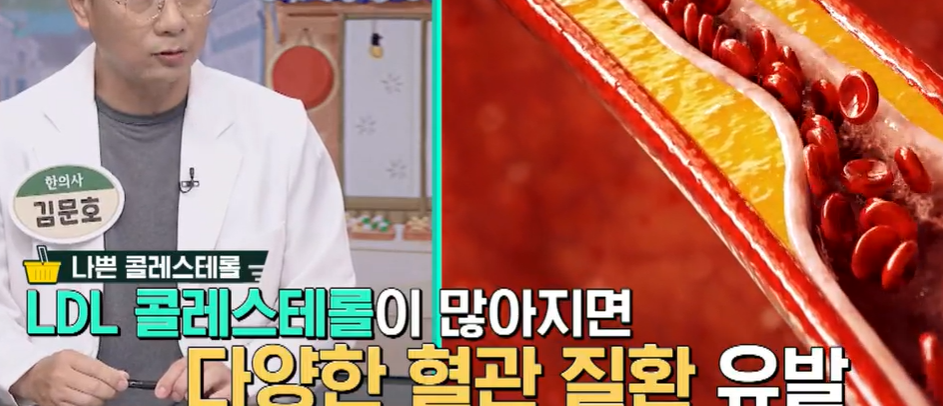 시서스 효능