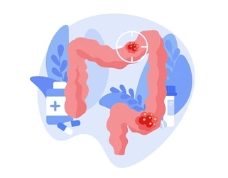 장염 원인 반응 감염 증상 정밀 감별 진단과 수액 치료방법
