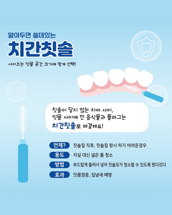 치간칫솔: 넓은 틈새도 문제없이 깨끗하게!- 광주뉴스TV