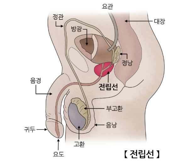 남성암 대표 전립선암&amp;#44; PSA 검사 바로보기 / 한국 남성 전립선암 치료&amp;#44; 증상&amp;#44; 검사