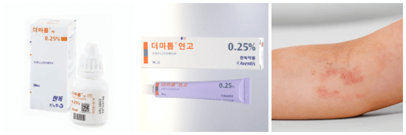 더마톱연고, 아토피 사진