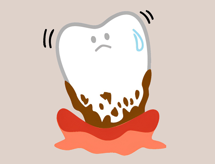 치주염으로-피가나는-잇몸