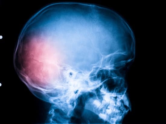 두부 외상 수술: 정의, 과정 및 중요성