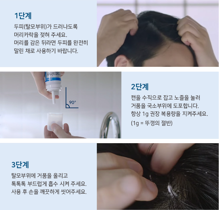 로게인폼 사용법