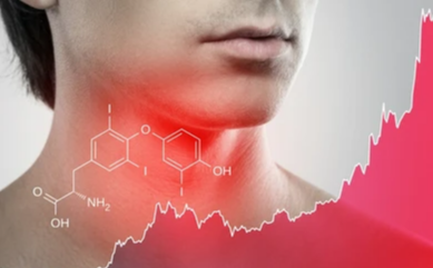 갑상선기능저하증 치료방법