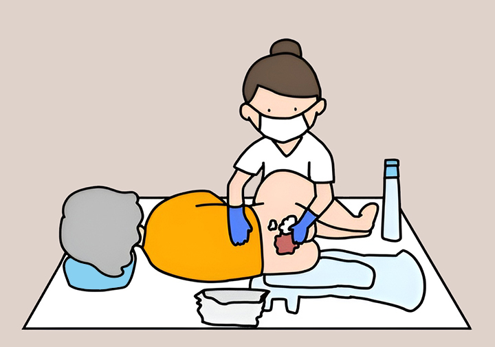 피부가-괴사한-환자를-치료하는-간호사