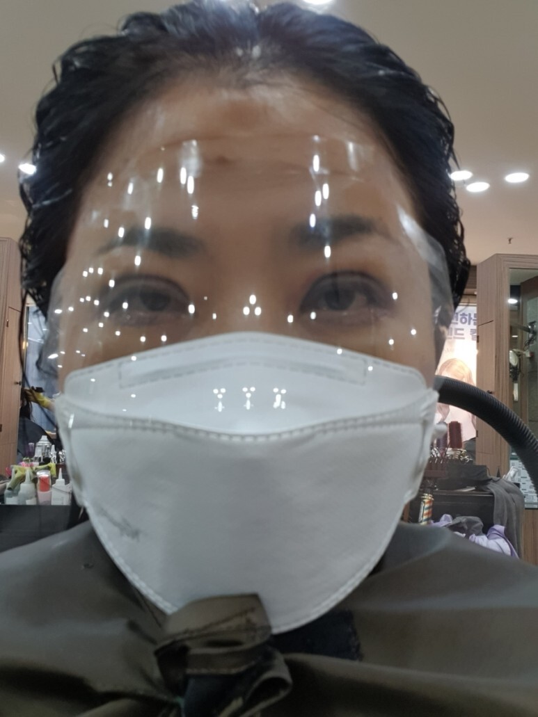 하안검 수술 후기