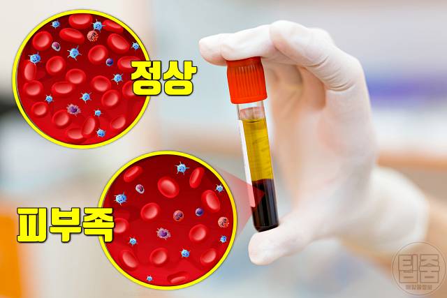 피가 부족할때 좋은 음식 피부족에 좋은 음식