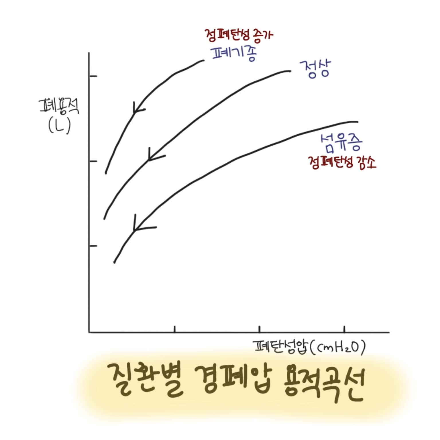 질환별 경폐압 용적곡선