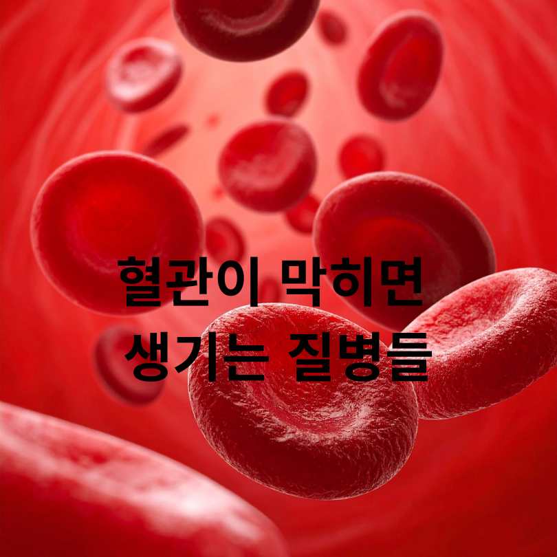 혈관이 막히는 이유? 당신이 몰랐던 진짜 원인들!