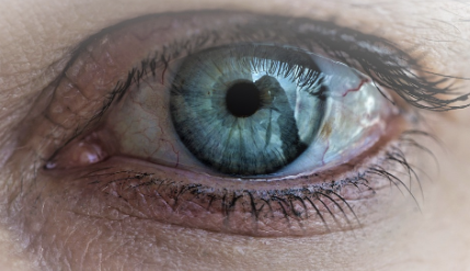 녹내장 초기증상 29