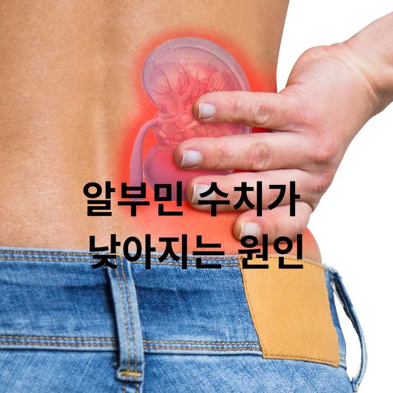 알부민 수치 낮을 때 나타나는 증상, 원인과 관리법