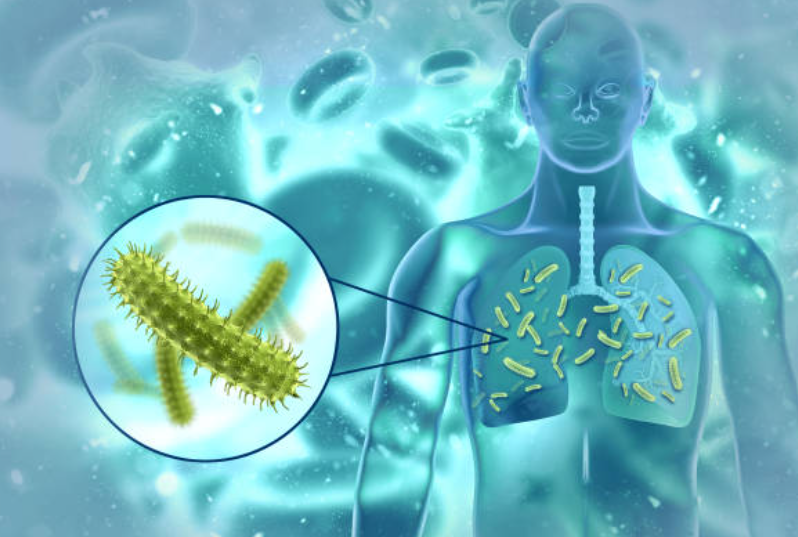급성 열성 감염병과 관련된 사진
