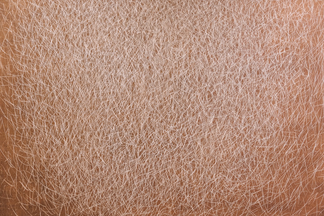 Acne
